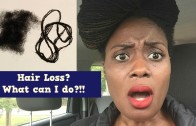 Hair Loss| Natural Hair   Locs and How to Address It